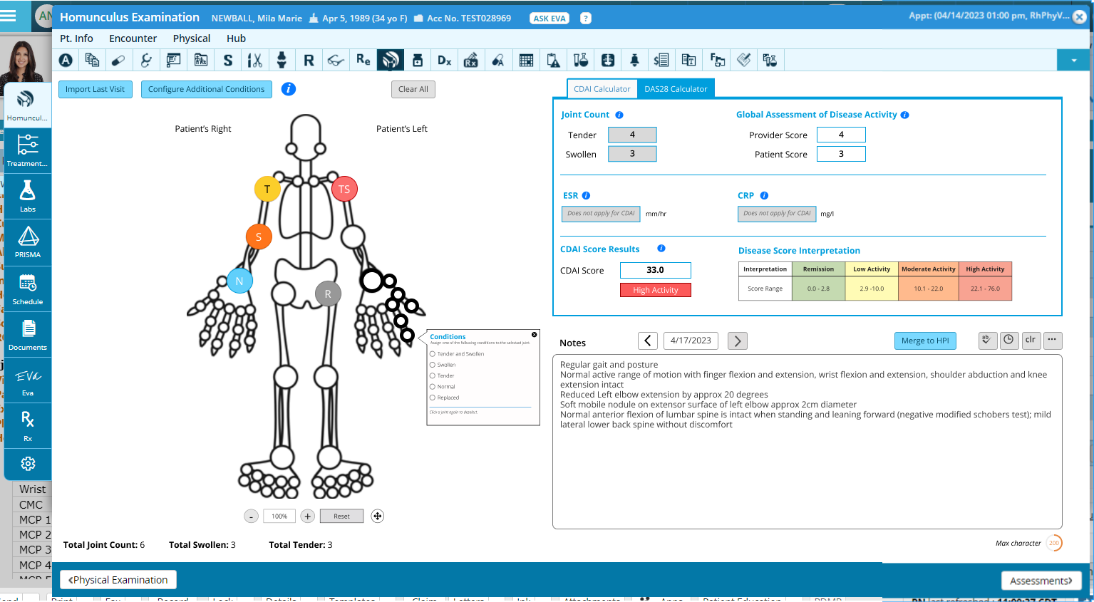 Cropped screenshot of the released Joint Examination Module with homunculus centered documentation and disease activity calculators.