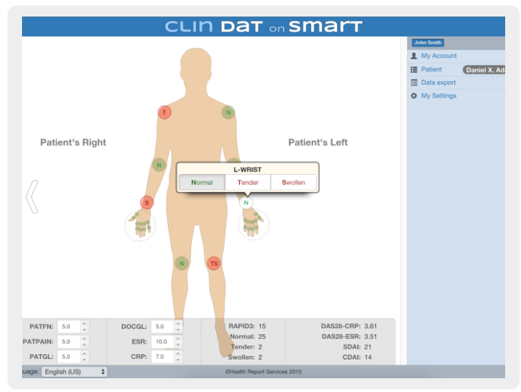 Reference example of a homunculus interface with joint condition controls.