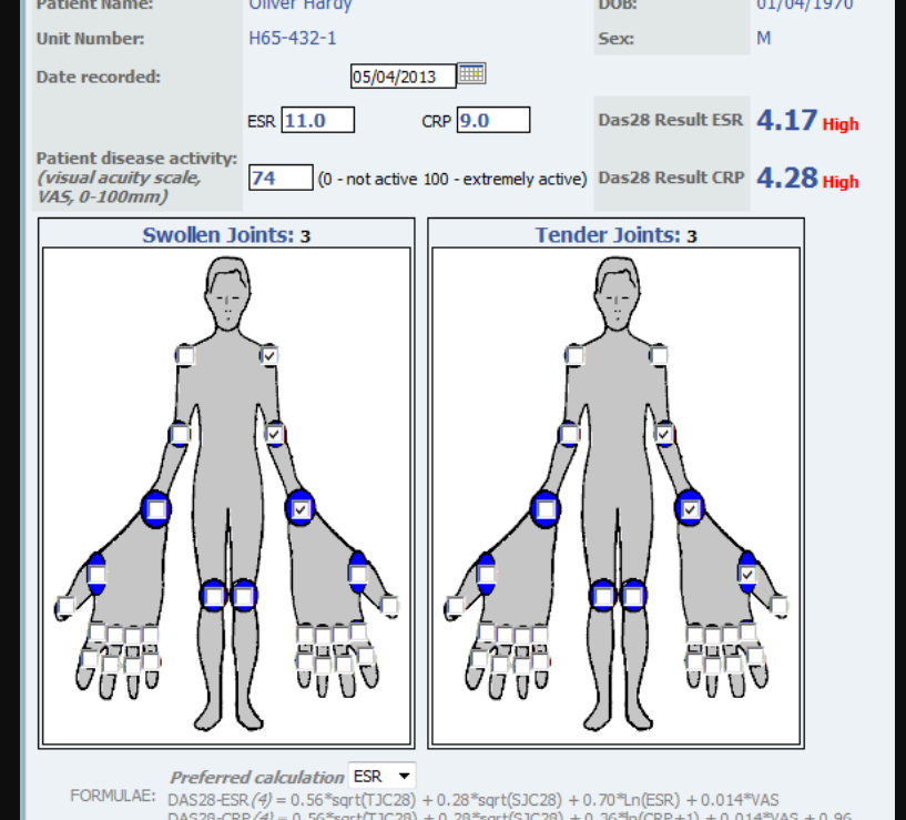 Reference example of a DAS28 calculator using tender and swollen joint diagrams.